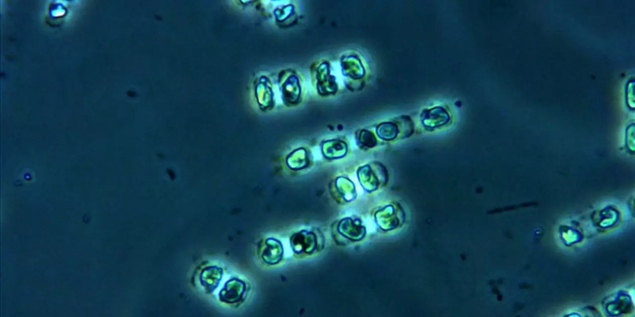 <p>Skeletonema costatum.</p>