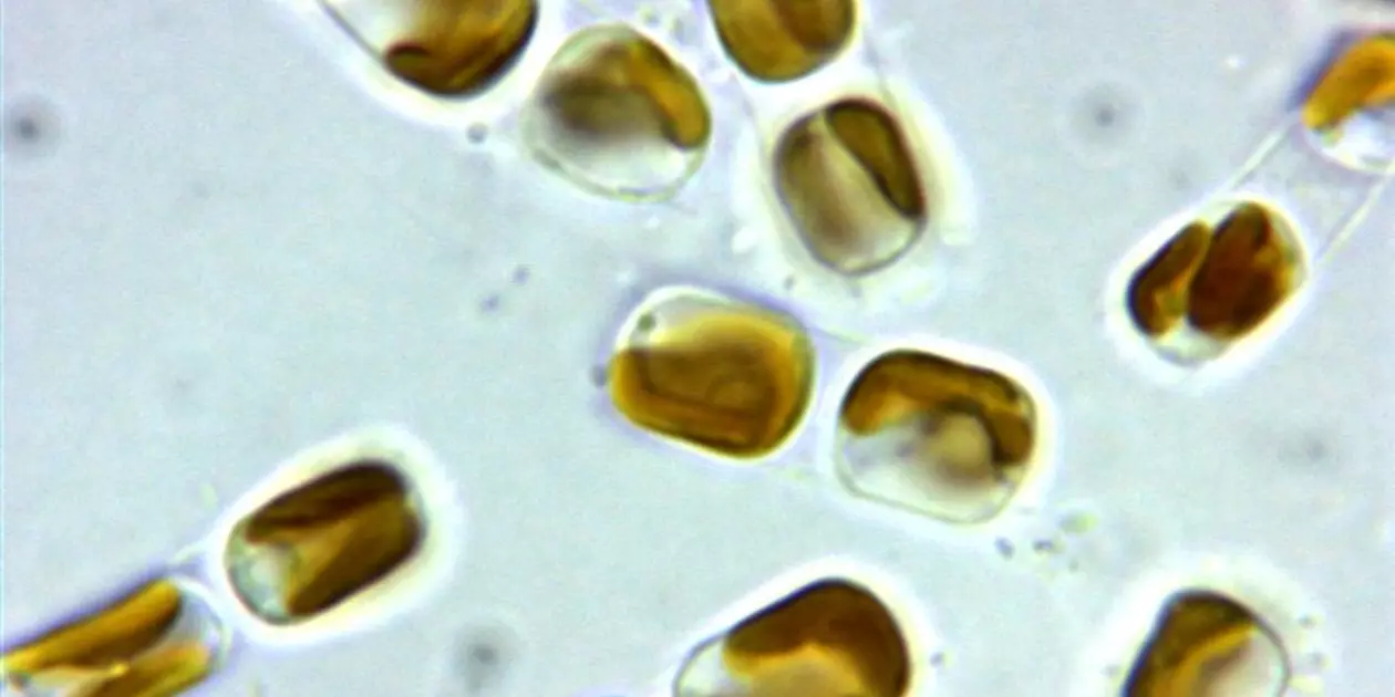 <p>Skeletonema pseucostatum.</p>