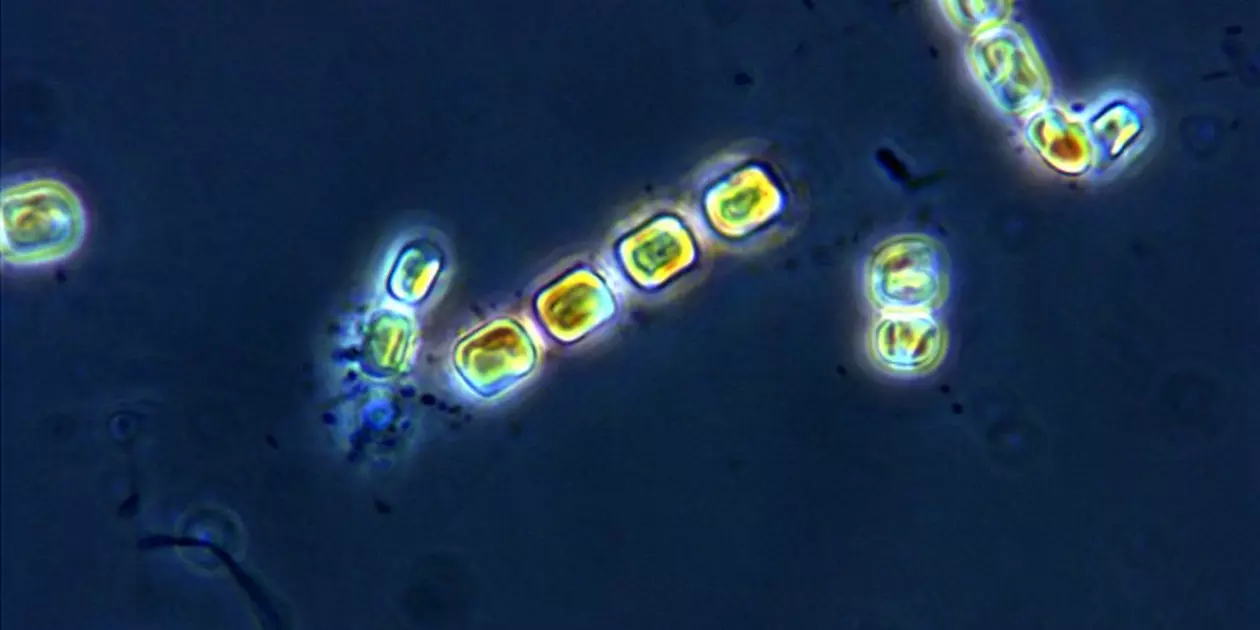 <p>Skeletonema pseucostatum.</p>