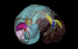La tomographie permet de "scanner" à 360°, à l'aide de rayons X, l'intérieur du corps du gastéropode, puis grâce à des traitements informatiques de reconstituer tous les organes en trois dimensions