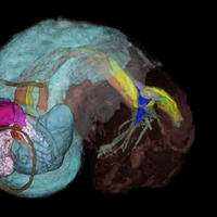La tomographie permet de "scanner" à 360°, à l'aide de rayons X, l'intérieur du corps du gastéropode, puis grâce à des traitements informatiques de reconstituer tous les organes en trois dimensions