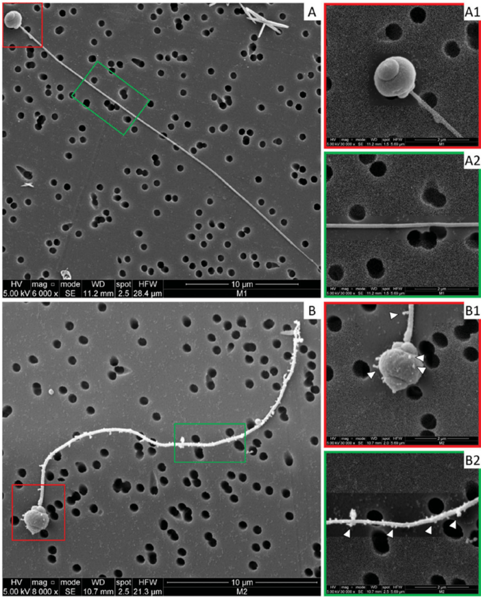 Figure : Observations par microscopie électronique à balayage de spermatozoïdes d’huître non exposés (A, A1, A2) ou après 1h d’exposition à des nano-billes de polystyrène de 50 nanomètres (concentration : 25 µg/mL)